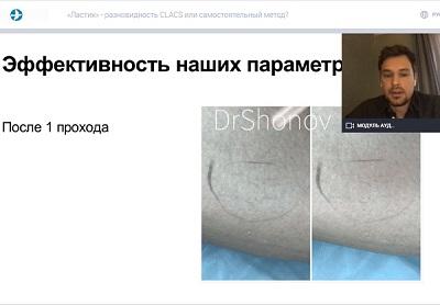 Докладывает О.А. Шонов (Санкт-Петербург)