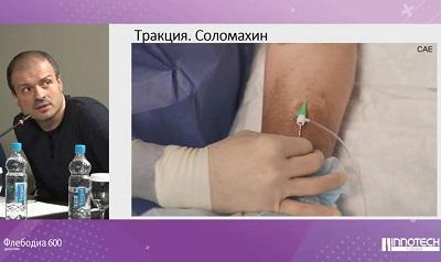 Руководитель &laquo;ЦИФ&raquo; Соломахин А.Е. демонстрирует свою технику проведения ЭВЛК