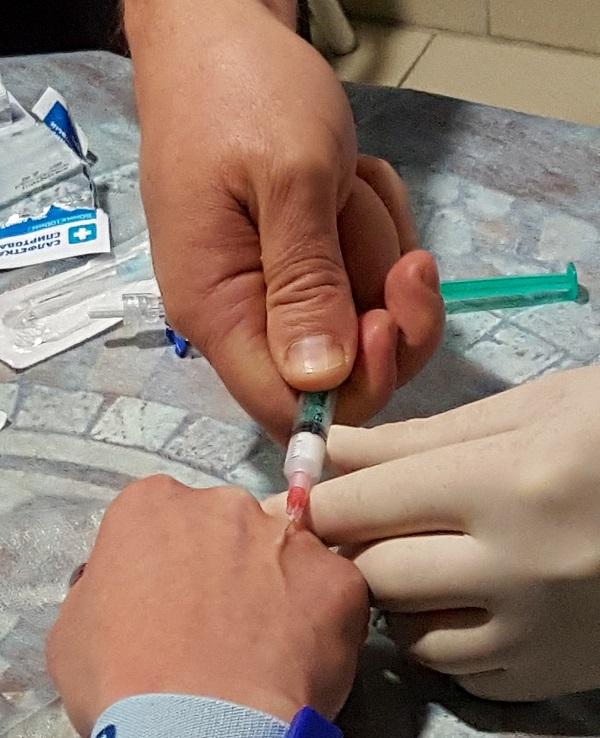 Техника склеротерапии одной рукой в исполнении доктора Семенова А.Ю.
