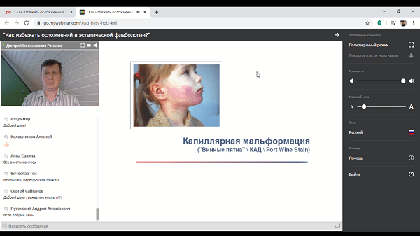 Капиллярная мальформация (винные пятна)