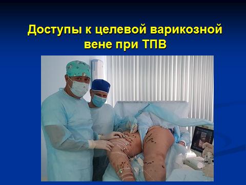 Доступы к целевой вене при тромбофлебите