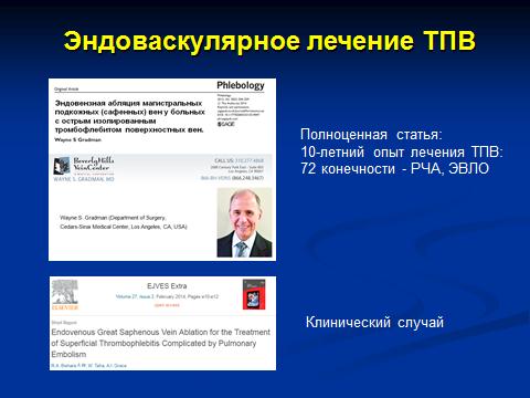 Wayne S. Gradman сообщил о своем опыте лечения пациентов с изолированным острым тромбофлебитом поверхностных вен с помощью эндовенозной абляции