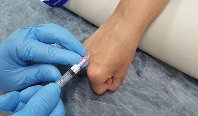 Склеротерапия на руках в нашем НИИ флебологии