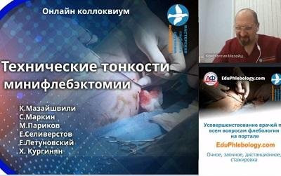 «Технические тонкости минифлебэктомии», онлайн коллоквиум с интерактивной дискуссией 28.04.2020г.