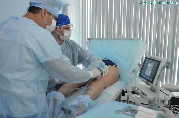 Эндовазальную лазерную процедуру проводят хирурги флебологи Семенов А.Ю. и Калачев И.И.